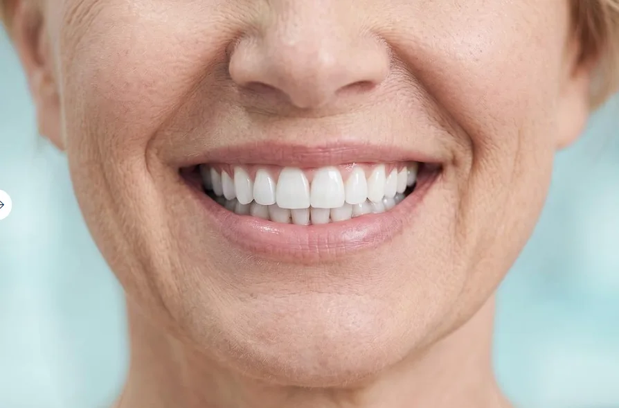 Smile after dental treatment at Vinayak Dental Hospital