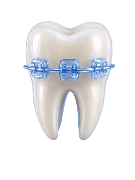 Teeth Braces